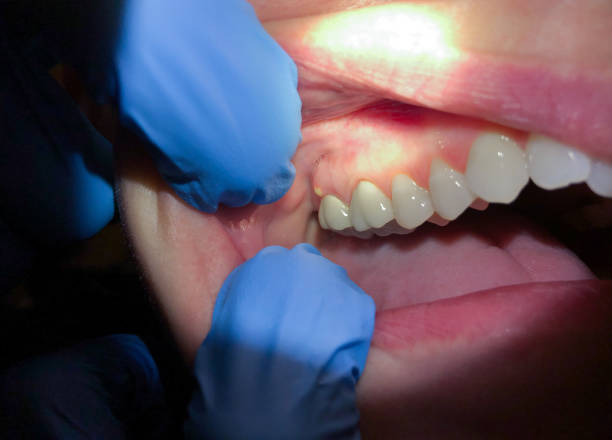 Best Emergency Treatment for Jaw Pain or Injury in Wheeling, IL